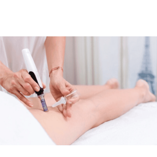 Mesoterapia Dermapen
